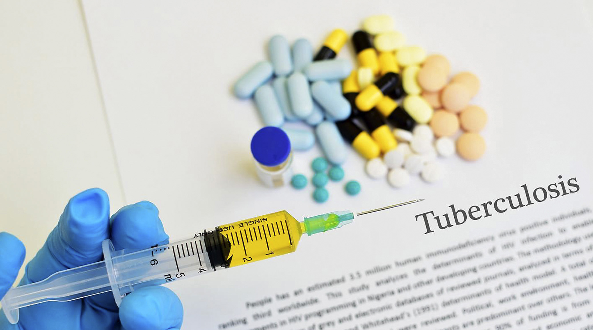 Finding ‘missing persons’ with TB a priority for new National Strategic Plan to combat the disease