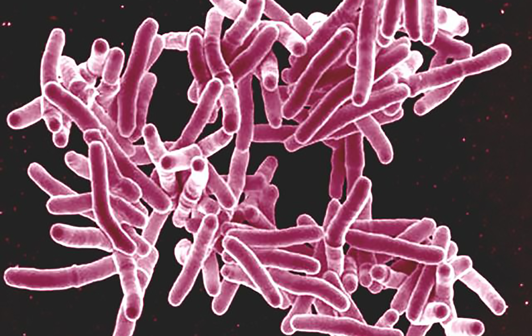 New drug-resistant TB medicines will save lives but high costs remain a concern for health equity