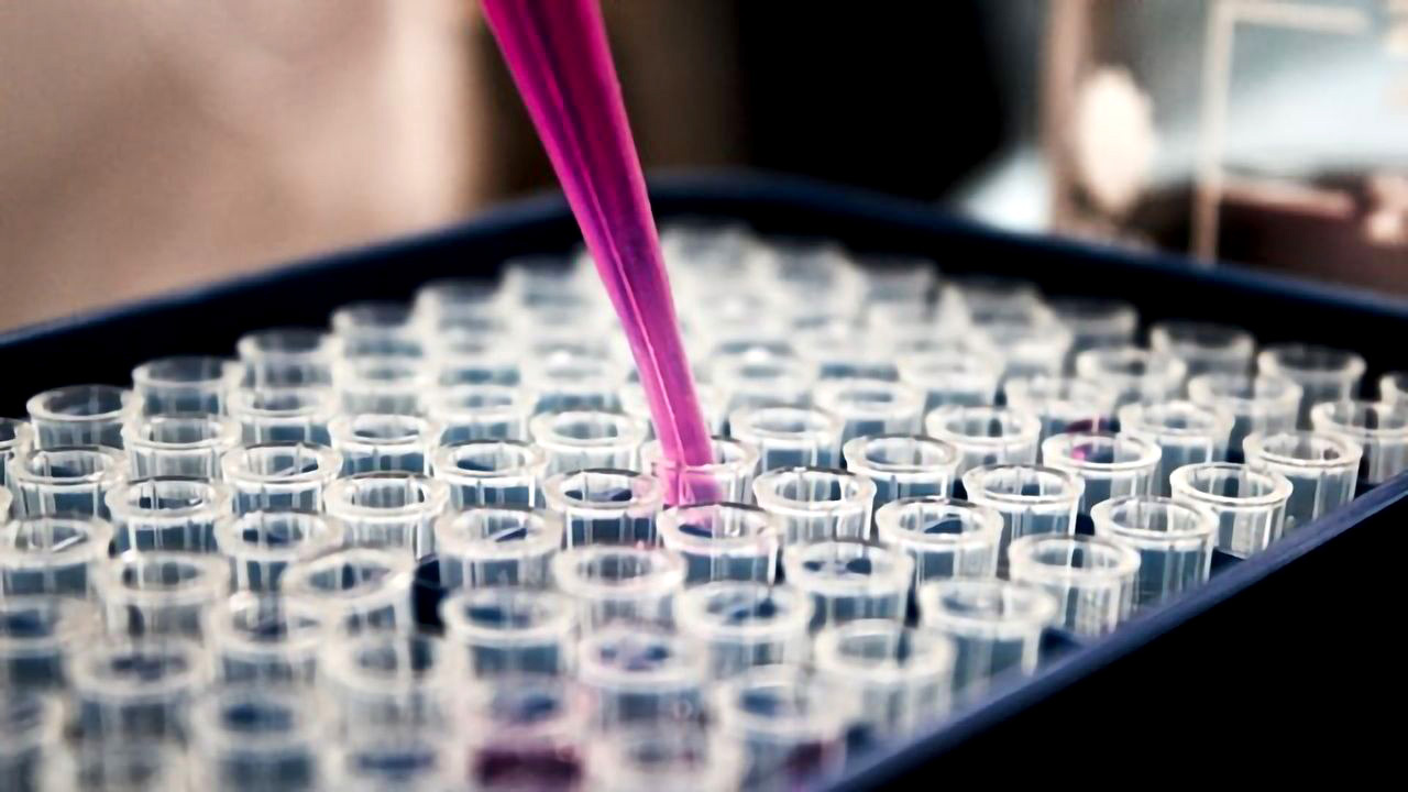 New TB testing strategy shows positive signs in early stages
