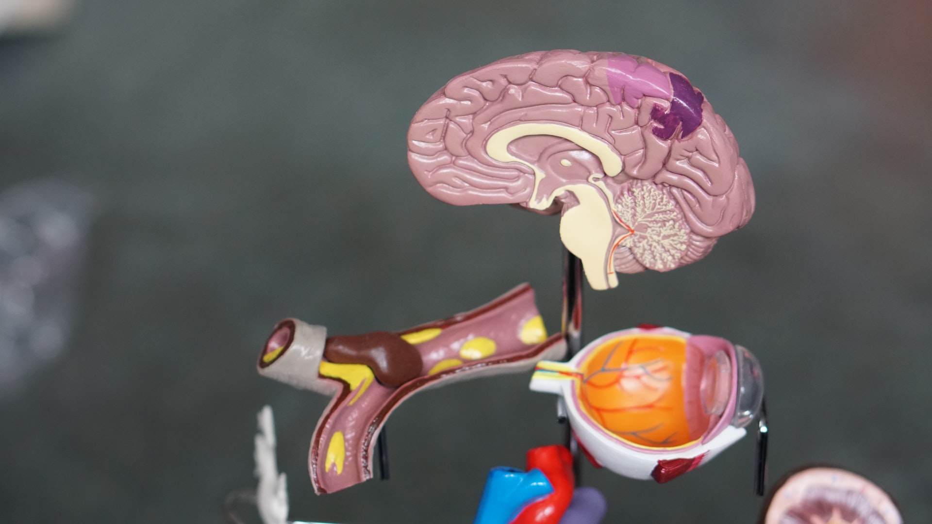 Stroke: young people can have them too – here’s how to know if you’re at risk and what to look out for