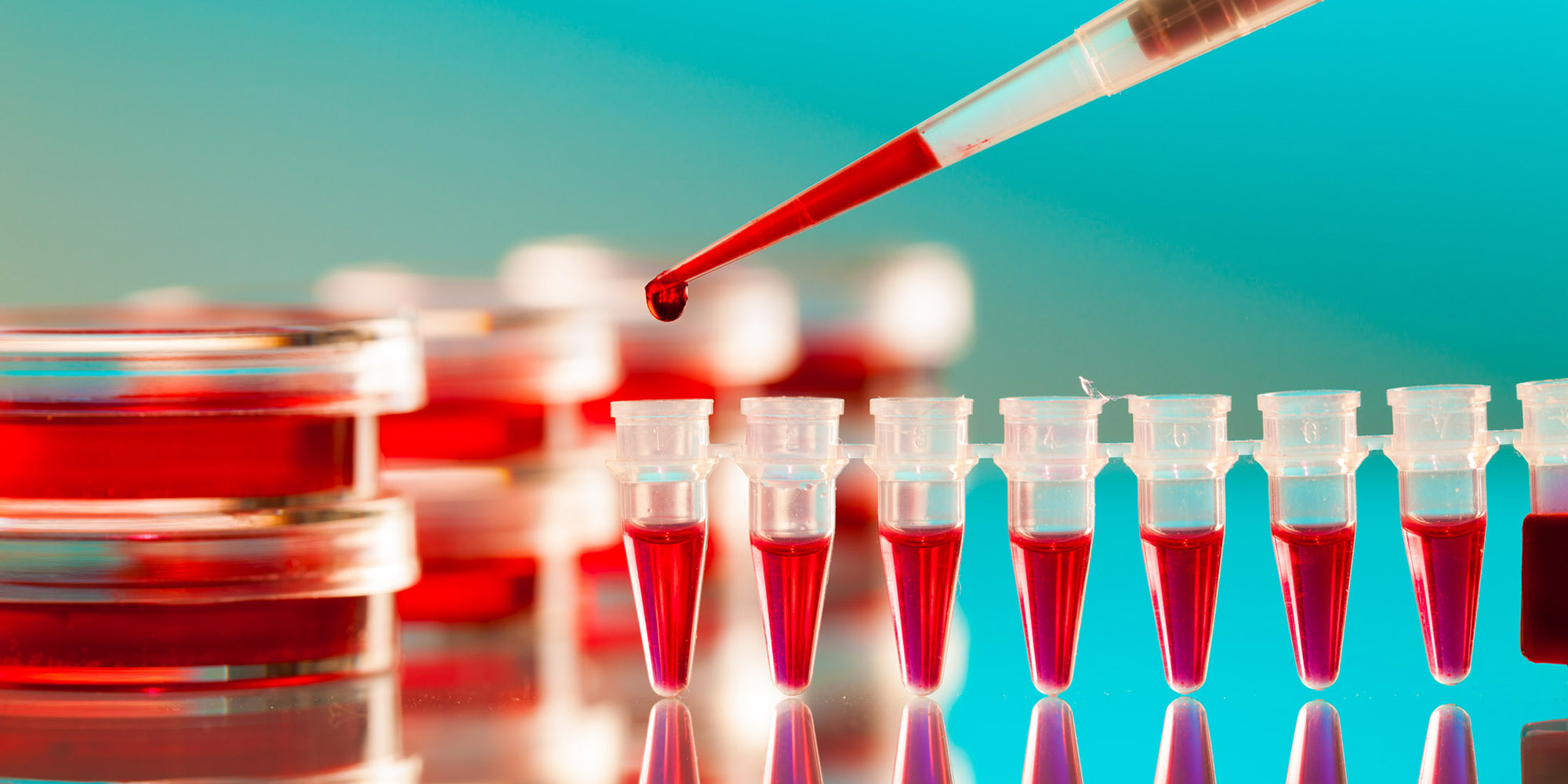 New HIV-prevention shot due in SA next year — but the catch is in the cost