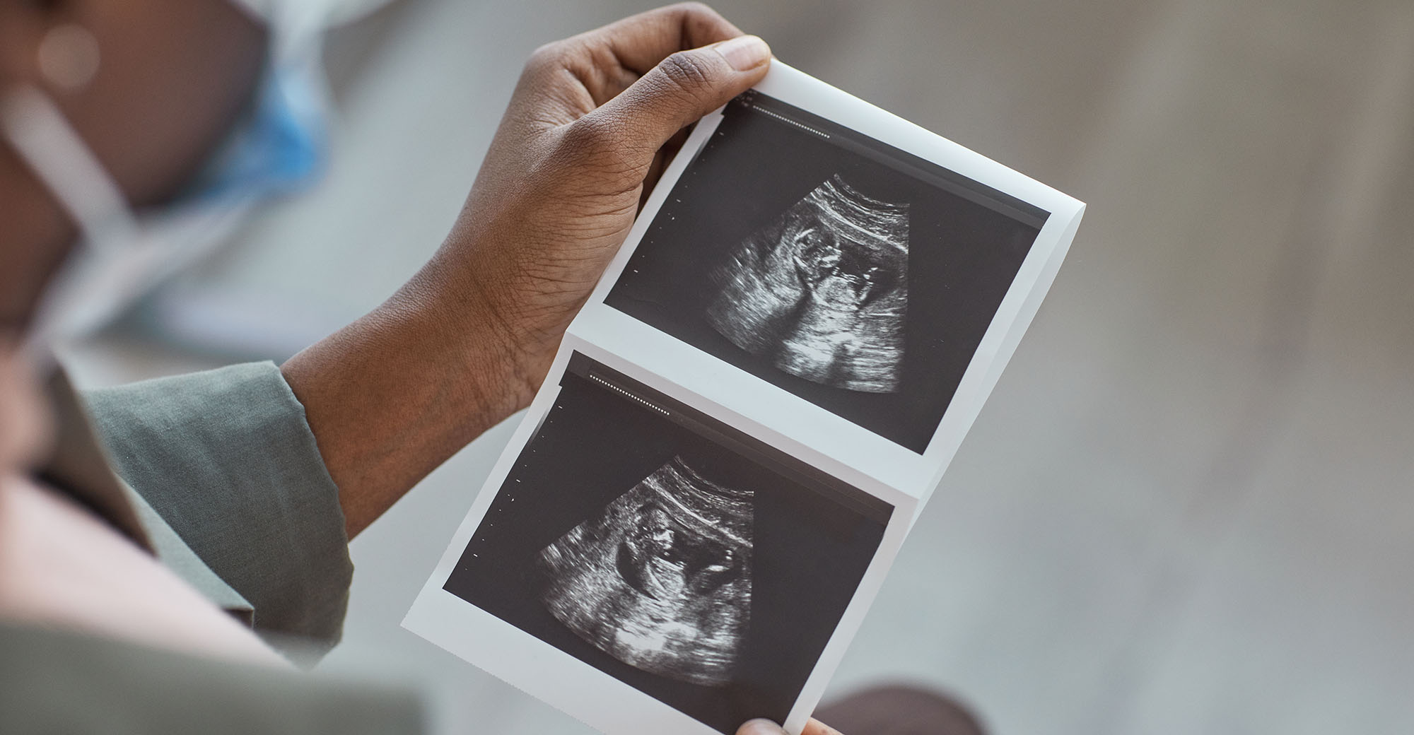 Global progress towards reducing maternal, newborn deaths stalls — hope lies in ‘accelerating together’