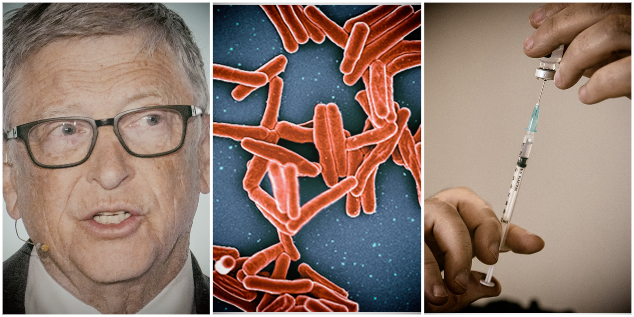 South Africa included in Gates-led clinical trial of new TB vaccine hailed as potential game-changer