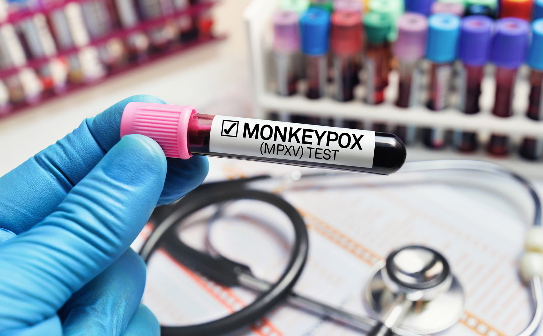 As the mpox virus sweeps through Africa, here’s what SA is doing to curb the outbreak
