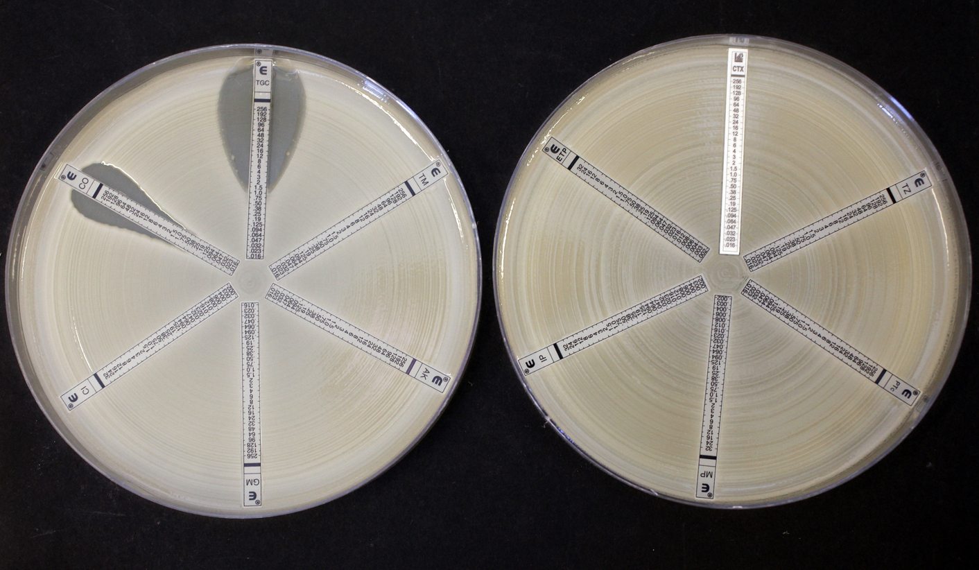 Health-e: The rise of the killer superbugs