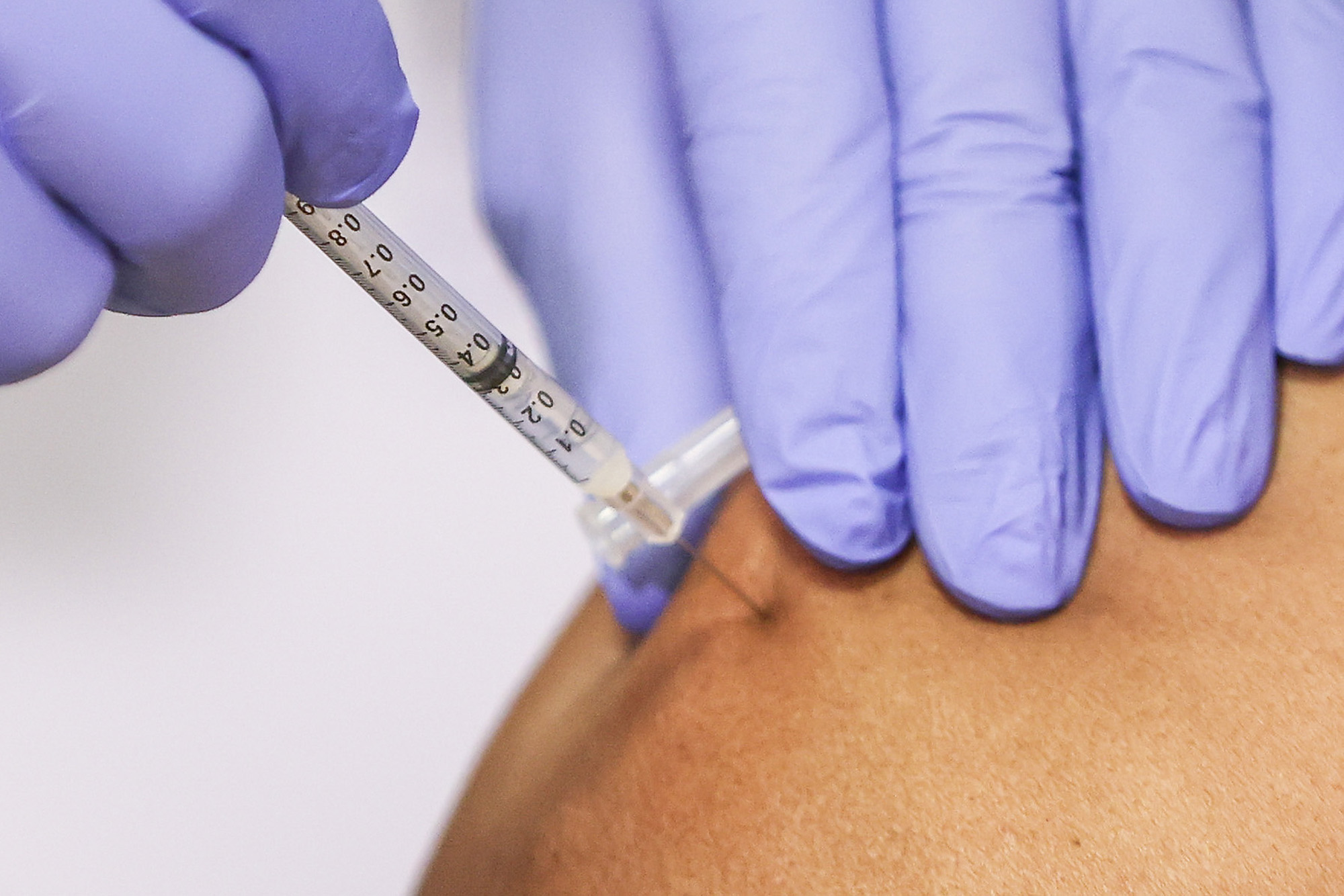 Global Virus Update: Variant spreads in US; NYC hospitalisations rise