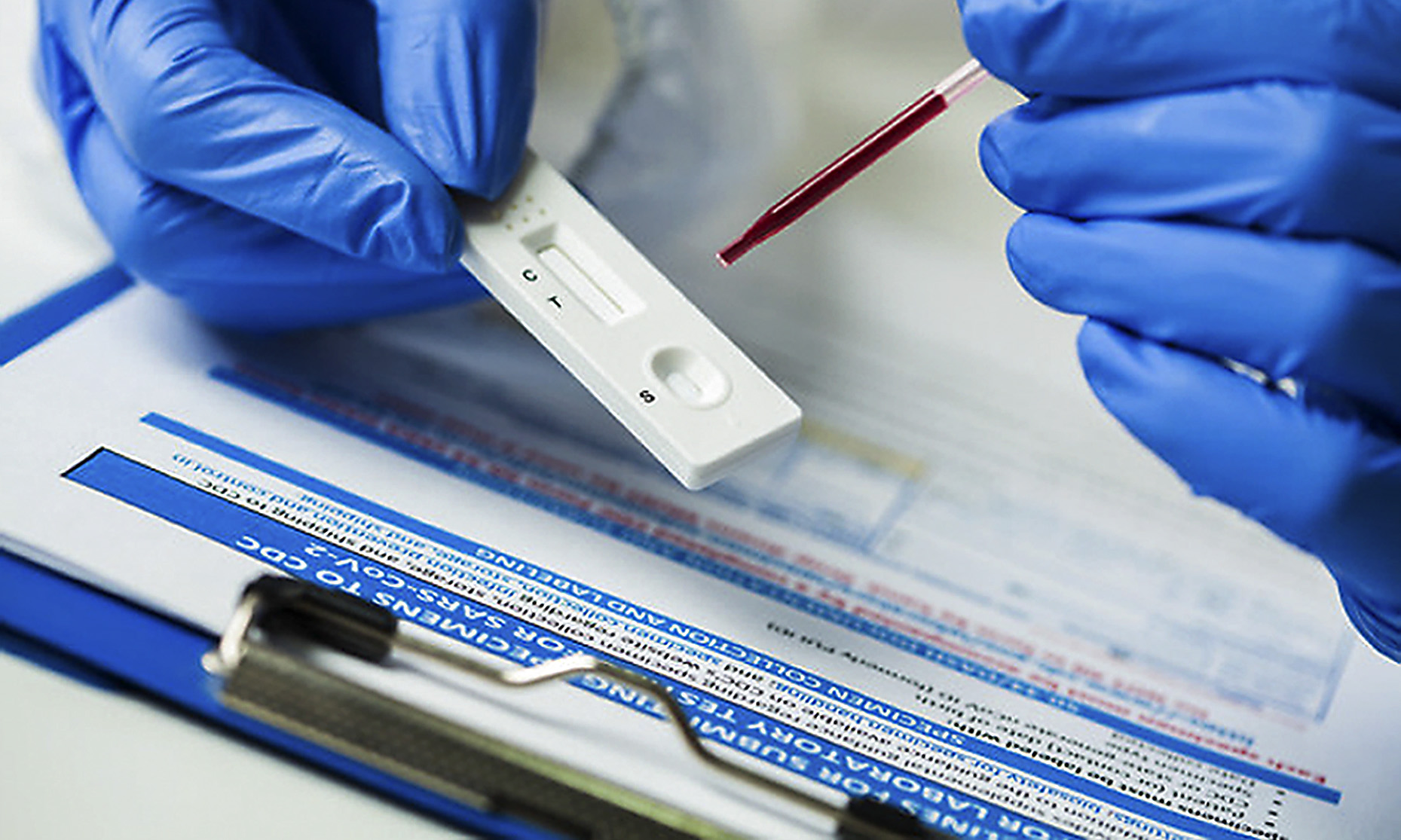 Covid-19 antibody tests on blood donors reveal high level of infection among South Africans