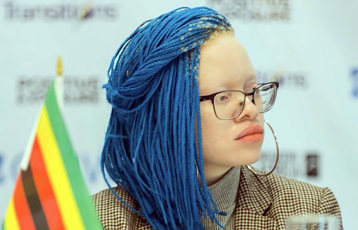 Challenging prejudice and normalising People With Albinism is the missing key, says activist