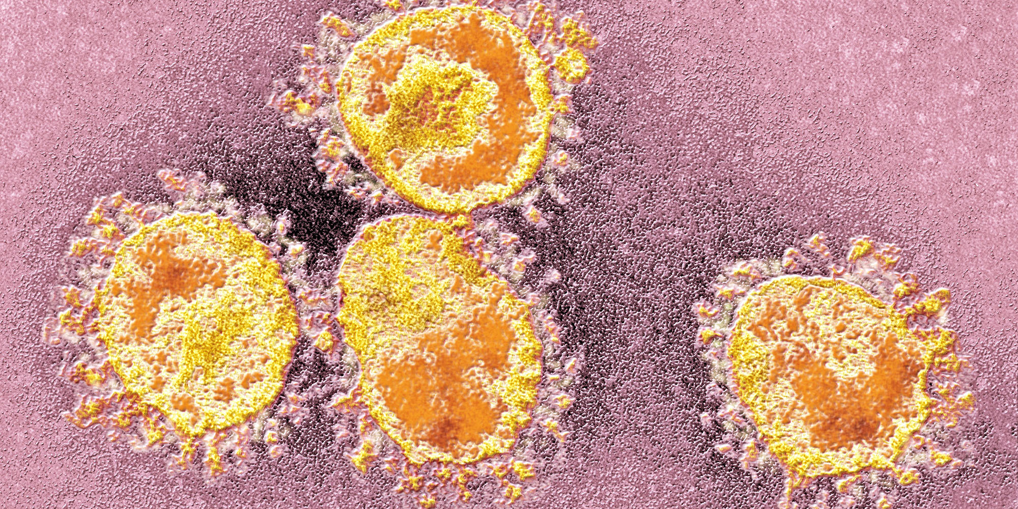 Virus literacy for beginners: Influenza and Covid-19