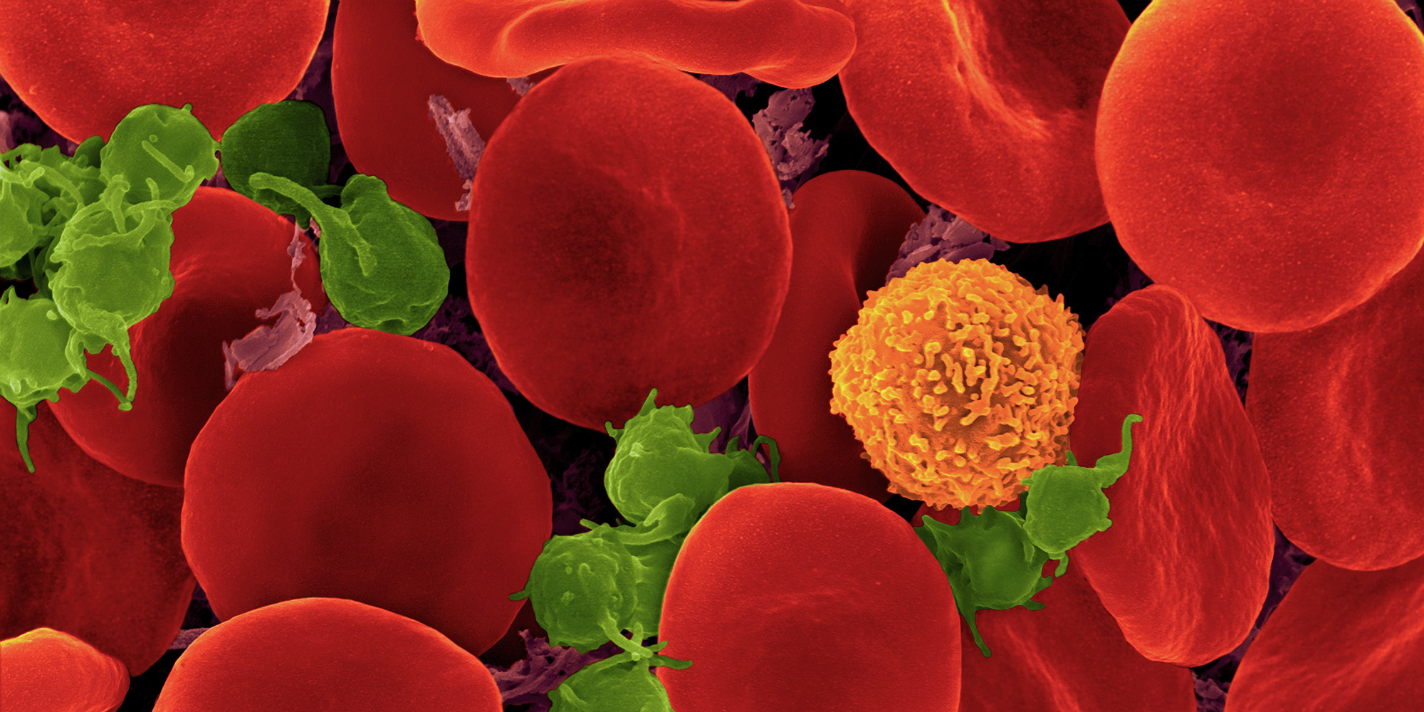 People living with HIV are dying because a medicine is not registered in SA