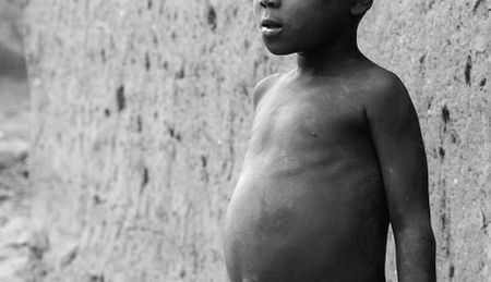 Western Cape to tackle ‘shocking’ stunting stats in ‘targeted’ nutrition scheme for moms, babies