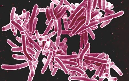 New drug-resistant TB medicines will save lives but high costs remain a concern for health equity
