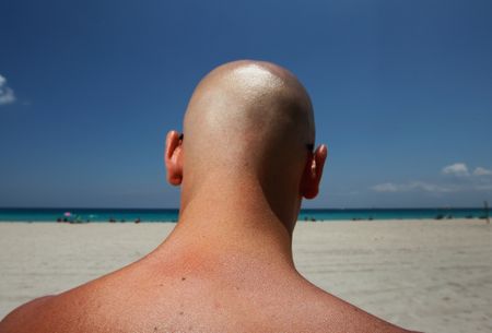 What’s the difference between freckles, sunspots and moles?