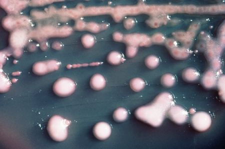 The horror scenario No. 23: scary supergenes that make even scarier superbugs