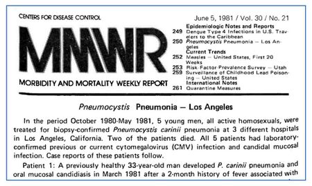 Forty years later - Let us not forget HIV/Aids