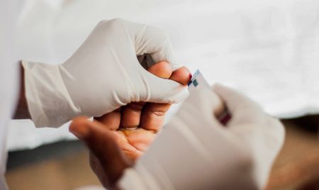 World Aids Day — It is vital to be vigilant on quality as we rush to test people for HIV