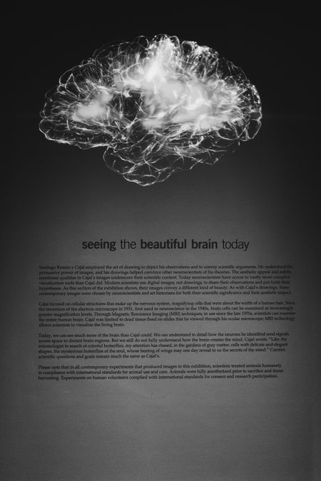 Investing in improved brain health is critical for a future-proof society