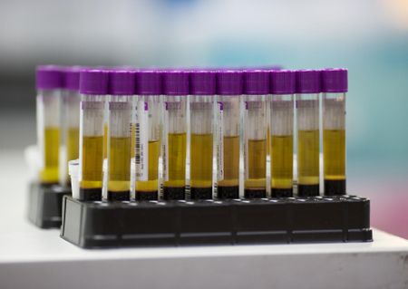 Australia scientists develop 'world first' melanoma blood test