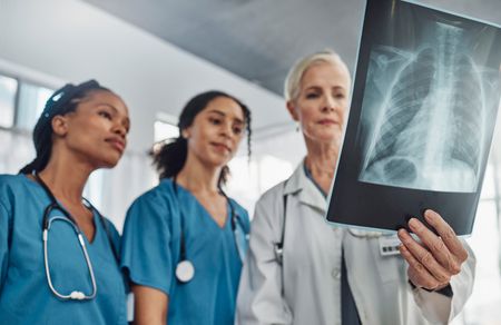 Can taking two pills a week slow down TB in South Africa? There’s a new plan in place