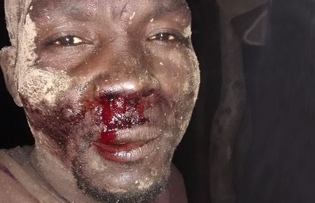 SANDF’s attacks on Gauteng’s Happiness Valley: A stark reminder of racialised denials of dignity and the limitations of the law