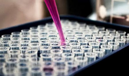 Even without donor support, South Africa has the means to eliminate tuberculosis