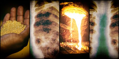 Tshiamiso Trust announces R9m in compensation roll-out to claimants in gold mining silicosis settlement
