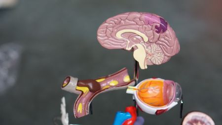 Stroke: young people can have them too – here’s how to know if you’re at risk and what to look out for