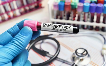 As the mpox virus sweeps through Africa, here’s what SA is doing to curb the outbreak