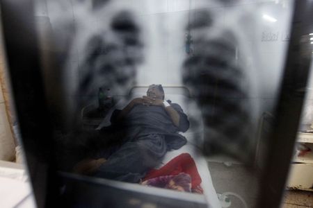 Diabetes and TB: Top killer diseases feed on each other