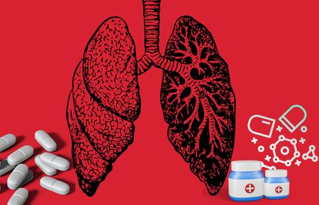 Competition law has again worked to fight a bad drug patent, but we need other solutions
