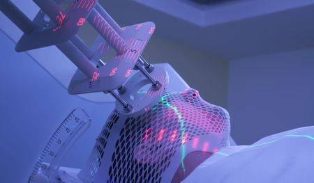 Beating the ‘Big C’ with a radioactive isotope flown into SA from Finland