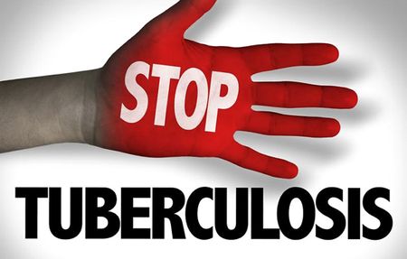 Support for TB patients just a phone call away
