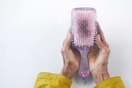 Hair loss and lower libido among long Covid symptoms – new research